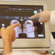 Visualizzazione ecografica nel lifting ad ultrasuoni microfocalizzati